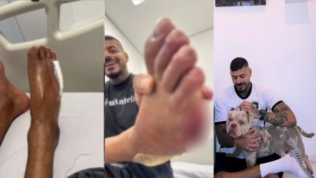 Cachorro come dedo de influenciador enquanto ele dormia